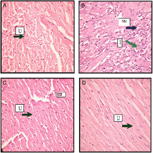 Figure 1.  Photomicrographs of histological changes of rat heart. (A) (40×) (−−, absence of change), Control group; (B) (40×) (+, 0–35% necrosis, inflammation); L-NAME (40 mg/kg, p.o.) group; (C) (40×) LS (500 mg/kg, p.o.) + L-NAME (40 mg/kg, p.o.) (−−, absence of change); (D) (40×) l-arginine (100 mg/kg p. o.) + L-NAME (40 mg/kg, p. o.) U, Unremarkable; NM, Necrotic myocardial cells; I, Inflammatory cells.