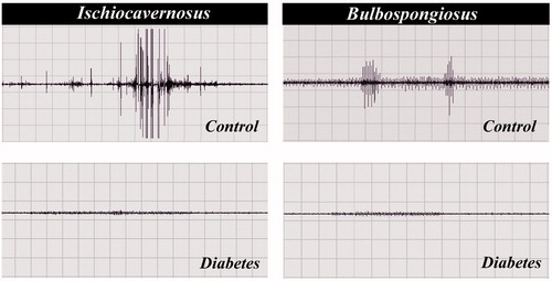 Figure 4. Electromyography showed activities of the IC and BS muscles in control and diabetic rats. Diabetic rat muscles showing diminish activities when compared to control indicting poor motor activity.