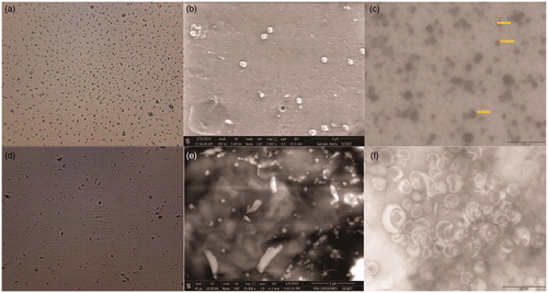 Figure 1. (a) Microscopic image of Simple dispersion of QTF (1500×). (b) SEM of simple dispersion of QTF. (c) TEM of simple dispersion of QTF. (d) Microscopic image of liposomal dispersion of QTF (1500×). (e) SEM of liposomal dispersion of QTF. (f) TEM of liposomal dispersion of QTF.
