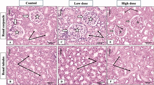 Figure 7. Illustrative photographs displaying the effect of low and high dose (100 and 200 mg/kg, respectively). MgO-zein nanowires on kidney histopathology in female rats (H & E stain × 200). Control group (A,B) showed normal renal corpuscles (white arrows) with its glomerular capillaries (stars), renal tubules showed intact normal cell lining (black arrows). Low dose group (C,D) showed an enlarged renal corpuscle with increase glomerular cellularity, no apparent change in renal tubules (black arrows). High dose group (E,F) showed normal renal corpuscle (white arrows) with a decrease in cellular density (stars) and increase mesangial substances (dotted arrows), renal tubules showed active large nuclei (black arrows).