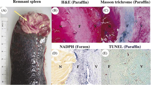 Figure 5. Histological examinations of remnant spleen. (A) The remnant spleen was removed 14 days after the procedure; arrow points to the dense adhesions. Histological examination showed a fibrous band (F) between viable splenic tissue (V) and necrotic tissue (N) (B: HE stain; C: Masson's trichrome stain; D: NADPH stain, for viability from frozen section; E: TUNEL assay from paraffin block; B-D: 10×, E: 100×).