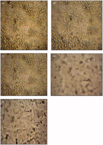 Figure 5. Photomicrographs of section of cerebral cortex in different groups; control group (A); flesh- and brain-treated groups (B) and (C) and liver- and viscera-treated groups (D) and (E) stained by TUNEL technique (magnification ×400). Cerebral cortex was fixed by direct immersion in a 4% paraformaldehyde in 0.1 M phosphate buffer. Serial sections (5 μm) were mounted on gelatin-coated glass slides cut and stained using the TUNEL technique (see section Materials and methods). →Apoptotic cells (arrows).