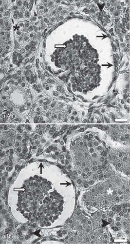 Figure 8. Representative light micrographs of renal cortex from a normal fetus (A) and an anencephalic fetus (B). The structure of the anencephalic kidney does not show a significant difference from the normal kidney. Arrow head, distal tubule; asterisk, proximal tubule; white arrow, glomerulus; black arrow, visceral sheet of Bowman capsule. Scale bar is 40 µm.