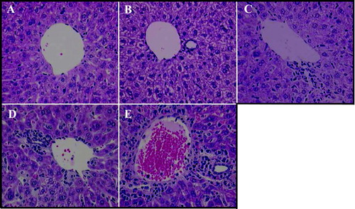 FIG. 2 Immune Cell Infiltrates in Liver Following Immunostimulatory ODN Treatment. Female mice were administered 50 mg/kg ISIS 2302 (q2d, sc) for 1 or 3 wk or 4 mg/kg ISIS 12449 as a single dose (S) or multiple dose (M; q2d for 1 wk). Liver was fixed in 10% formalin and sections were stained with Hemotoxilin/Eosin. The panels are representative photomicrographs of each treatment group: A, PBS; B, ISIS 2302 (1 wk); C, ISIS 2302 (3 wk); D, ISIS 12449 S; E, ISIS 12449 M.