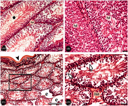 Figure 4. The light microscopical sections of testis belonging to the non-obese thymoquinone (NT) and obese thymoquinone (OT) groups are shown. (A and B) The light microscopical sections of testis belonging to the NT group. Star: intensive sperm in the tubule lumen, Sd: intensive spermatid in the tubule lumen, Int: interstitial area. (C and D) The light microscopical sections of testis belonging to the OT group. Arrowhead: tunica albuginea, e: enlarged peritubular tissue, arrows: germ cell loss. Framed area of C was indicated in D at higher magnification. Histological structure of testis is seen in the NT and OT groups. In the NT group more spermatogenic cells were seen on the seminiferous tubule walls compared to those of the NC group. Degenerated cells were decreased and no atrophic tubules were seen in OT group. Dye: HE; Scale Bars: (B–D) 25 µm; (A–C) 150 µm.