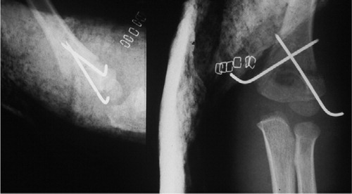 Figure 6. Immediately after operation.