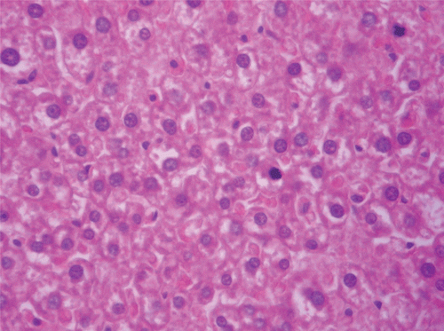 Figure 8.  Histopathologic presentation of male rat liver of CF 1000 mg/kg group (Intracellular accumulations/Fatty change; 400×).