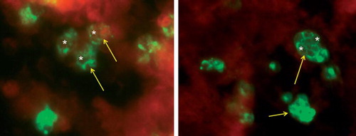 Figure 1. Left panel: Human monocytes infected with C. trachomatis for 6 days. Cells were fixed with 70% methanol, then stained for chlamydial lipopolysaccharide (Pathfinder, BioRad, Hercules, CA, USA). Green fluorescence indicates chlamydial infection (arrows). Note large circular structures which are aberrant reticulate bodies (RB) (white asterisks). These are similar in size to aberrant RB after 48 hours of infection induced by penicillin G treatment of HEp-2 cells at the time of infection (right panel). Images collected with the assistance of MsMirabelaHali, Wayne State University.