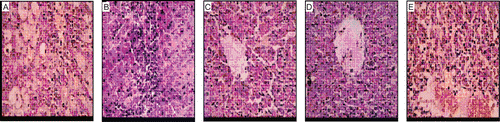 Figure 3.  Photomicrographs of histological changes in the mice liver. (A) Non-diabetic; (B) Diabetic control; (C) Acarbose (50 mg/kg, p.o.); (D) MUAI (1 mg/kg, p.o.); (E) MUAI (1 mg/kg, p.o.)+2% starch solution.