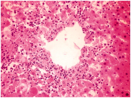 Figure 2. Toxic control group rat liver section showing disarrangement and degeneration of normal hepatic cells with intense centrilobular necrosis.