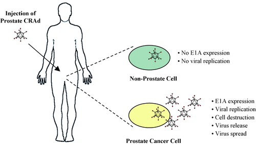 Figure 2. Oncolytic adenovirus therapy. A conditionally replication-competent adenovirus (CRAd) with E1A gene expression controlled by a prostate-specific promoter specifically replicates in and lyses cells of prostate epithelial origin, including prostate adenocarcinoma cells. The oncolytic prostate CRAd virus may be injected intraprostatically in patients with localized prostate cancer or intravascularly in patients with metastatic prostate cancer.