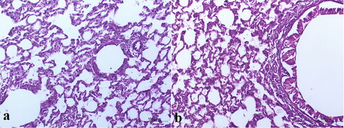Figure 7. Light photomicrographs showing histopathological sections of (a) control untreated rat lung and (b) rat lung received an intratracheal suspension of TBN-NVS formulation (200X H & E).