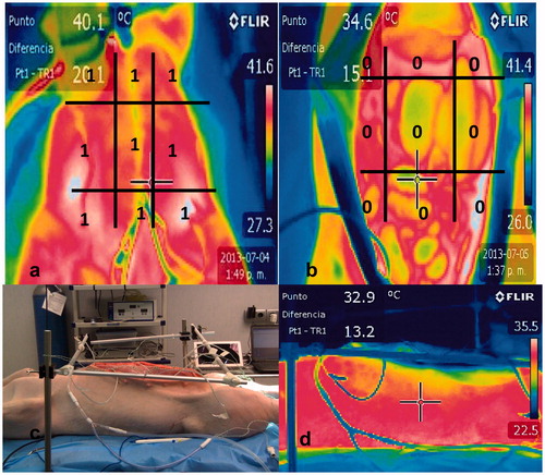 Figure 3. a. Temperature homogeneous distribution in a pig closed HIPEC model. b. Temperature and colours heterogeneity in a pig open HIPEC model. c. Lateral view of a pig that is treated using open HIPEC. d. Depth thermographic distribution, between laparotomy to retroperitoneum, was homogeneous.