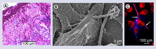 Figure 1. Candida albicans morphology during interaction with host cells.(A) Histological section showing C. albicans hyphae invading the murine liver 24 h after intraperitoneal infection. Scale bar = 100 µm. (B) Scanning electron microscopy of C. albicans invasion into oral epithelial cells after 3 h coincubation. A C. albicans hypha penetrates the epithelial cell, grows through the cell, exits the epithelial cell and invades another epithelial cell. The second hyphal cell is not invasive. Scale bar = 3 µm. Kindly provided by Gudrun Holland and Norbert Bannert (Robert Koch Institut, Berlin). (C) Fluorescence microscopy picture of human macrophages (J774) interacting with C. albicans cells after 2 h of coincubation. Red: macrophages; pink: extracellular C. albicans; blue: intracellular C. albicans. Two C. albicans hyphae have pierced a macrophage to escape (arrows). Scale bar = 100 µm.