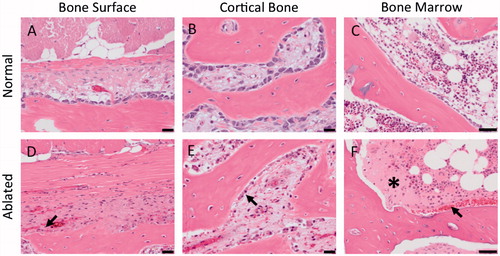 Figure 9. Haematoxylin and eosin histology showing the cellular changes in the bone adjacent to the ablated MB nerve. Compared to control tissue, ablated bone had the following changes: shrinkage of osteoblasts (arrow D, E) and increased eosinophilia of the extracellular spaces (asterisk) and haemorrhage (arrow) in bone marrow (F). 50 μm scale bar.