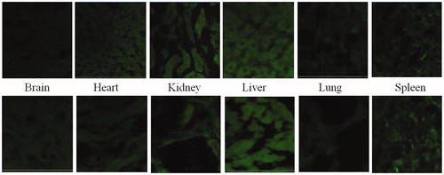 Figure 16. Qualitiative biodistribution studies for pristine dye and dye-loaded PLGA formulations. The fluorescence in the brain section was markedly enhanced for the animals treated with fluorophore-loaded nanoparticles as compared to only dye treated animals. Further, the fluorescence in tissues such as kidneys, liver and lungs was lesser for the animal tissues treated with nanoparticles loaded with fluorophore. Whereas, for organs of animals like spleen and lungs treated with free fluorophore and fluorophore loaded into nanoparticles, fluorescence remained more or less same.
