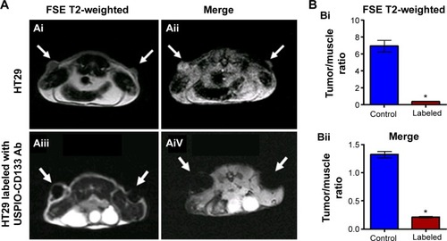 Figure 4 Detection of tumors by MRI in nude mice implanted with HT29 cells ex vivo labeled with USPIO-CD133 Ab.Notes: (A) On day 14 after subcutaneous injection of HT29 cells without (Ai and Aii) or with ex vivo labeling of USPIO-CD133 Ab (Aiii and Aiv), xenografted tumors were noted at both flanks (arrows) and scanned by MRI for FSE T2-weighted (Ai and Aiii) and Merge (Aii and Aiv) images. (B) The representative signal ratio of tumor/muscle in MR images, including FSE T2-weighted (Bi) and Merge images (Bii). Bar, SE; *P<0.05.Abbreviations: FSE, fast spin echo; MRI, magnetic resonance imgaing; Merge, multiple echo recombined gradient echo; SE, standard error of the mean; USPIO-CD133 Ab, ultrasmall superparamagnetic iron oxide conjugated with anti-CD133 antibodies.