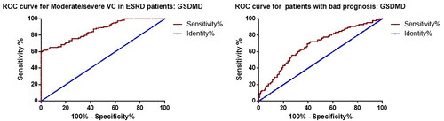Figure 2. ROC curves for GSDMD for moderate/severe VC and prognosis in ESKD patients.