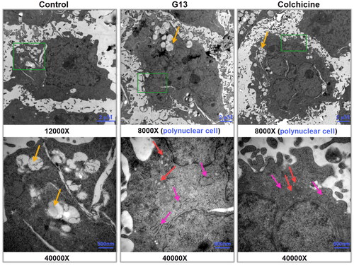 Figure 6. Transmission electron micrographs of MDA-MB-231 cells treated with 0.1% DMSO (control group), G13 (5 μM) or colchicine (5 μM) for 48 h. The green area in the top micrographs was enlarged below the micrographs. The yellow arrows illustrated a lot of fat droplets in cells. The red arrows illustrated the ultrastructural alterations of mitochondria. The pink arrows indicated the endoplasmic reticulum became dilation. Cells treated with G13 or colchicine resulted in the formation of polynuclear cells.