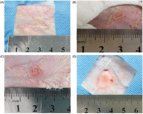 Figure 5. Visual inspection of skin injuries on post-procedure day 1. Representative photographs of the gross skin injuries on post-procedure day 1. (A) Erythema in the perfusion group. (B) A vesicle in the pre-injection group. (C, D) Ulceration in the control group (54 × 50 mm, 300 × 300 dpi).