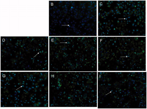 Figure 4. ROS production was determined by CellRox Green and Hoechst 33342 staining in rat primary hepatocytes. Rat primary hepatocytes were pre-incubated with Poly-[Hb-SOD-CAT-CA] or PolySFHb for 2 h before treated with 200 mmol/L alcohol for 12 h. B: control, C: 200 mm alcohol, D: 5 μL PolyHb-SOD-CAT-CA +200 mm alcohol, E: 10 μL PolyHb-SOD-CAT-CA +200 mm alcohol, F: 15 μL PolyHb-SOD-CAT-CA +200 mm alcohol, G: 5 μL PolyHb +200 mm alcohol, H: 10 μL PolyHb +200 mm alcohol, I: 15 μL PolyHb +200 mm alcohol (arrow points an example of overlap of staining).