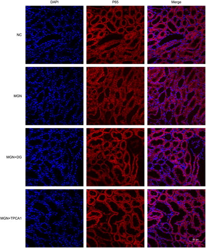 Figure 9. Effect of DG on NF-κB p65 nuclear translocation in MGN rats. NF-κB p65 expression was detected using immunofluorescence staining. NC: normal control; MGN: membranous glomerulonephritis; DG: diosgenin; TPCA1: [(aminocarbony)amino]-5-(4-fluorophenyl)-3-thiophenecarboxamide. Scale bar: 50 μm.