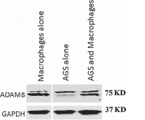 Figure 5. A western blot of ADAM8 protein expression in macrophages or AGS cells grown alone or in co-culture. ADAM8 bands are shown near 75 kD and the possible proform near 90 kD.