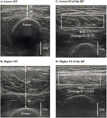 Figure 1. Ultrasound images of the quadriceps. (a,b) Thicknesses of the subcutaneous fat (SF), rectus femoris (RF) and vastus intermedius (VI) were measured at the position perpendicular to the femur in each image. (c,d) Dotted rectangle indicates maximum region of interest (ROI) in the RF. All images in Figure 1 were derived from our data, and have not been published elsewhere.