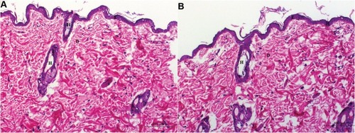 Figure 5 Light photomicrographs showing histopathological sections of (A) Normal untreated rat skin and (B) Rat skin treated with DH- TENV gel (X200 H&E stain).