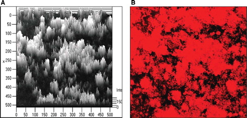Figure 19. Biofilm formation by E. coli Nissle 1917 (EcN) in vitro as demonstrated by laser scanning microscopy. (A) Computer-assisted height measurement; (B) density measurement. Pictures taken from: J. Schulze, M. Schiemann, U. Sonnenborn. 120 years of E. coli – its importance in research and medicine. Alfred-Nissle-Gesellschaft, editor. Hagen, p 33, 2006; with kind permission. Scanning micrographs courtesy of U. Dobrindt and H. Merkert, University of Wuerzburg, Germany.