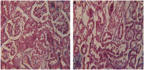 Figure 2. Photomicrographs of group G (gentamicin treated): (A) renal cortex showing renal cortex presenting glomerular atrophy with hydropic changes and proximal tubular cell necrosis and loss of cellular pattern and (B) renal medulla showing loss of cellular pattern with a number of ruptured tubules; the dilated collecting tubules also significantly present.