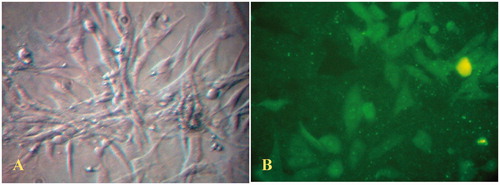 Figure 1. (A) Phase contrast light photomicrograph of confluent monolayer of cultured rat mesenteric endothelial cells (magnification 400×). (B) Immunofluorescent staining of mesenteric endothelial cells for Von-Willebrand factor (magnification 400×). The data are representative of three independent experiments. Further details are given in experimental procedures.