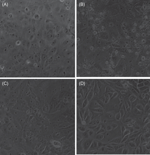 Figure 2.  Effect of stannous chloride (SnCl2) on potassium dichromate (K2Cr2O7)-induced toxicity on LLC-PK1 cells. The cells were incubated without or with treatment for 24 h at the end of which light microscopy micrographs were taken (200×). (A) Control cells; (B) K2Cr2O7 (30 μM)-treated cells; (C) SnCl2 (200 μM)-treated cells; (D) K2Cr2O7- and SnCl2-treated cells.