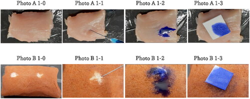 Figure 1. A–B. Injection procedure with VTT-T mock tissue (A) and BCM tissue (B) and dye liquid (PBS colored with bromophenol blue). The backflow was collected with filter paper immediately after needle removal. 1–0 Overall view of the BCM model.1–1 Injection in the BCM model.1–2 Backflow following needle removal in the BCM model.1–3 collection of backflow with filter paper in the BCM model. 1B. 1–0 Overall view of the VTT and VTT-T models. 1–1 Injection in the VTT and VTT-T models. 1-2 Backflow following needle removal in the VTT and VTT-T models. B1-3 Collection of backflow with filter paper in the VTT and VTT-T models.