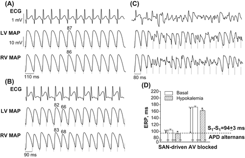 Figure 5. Arrhythmogenic responses during rapid cardiac pacing (panels A, B, and C), and changes in effective refractory periods (panel D) determined in hypokalemic heart preparations. Panels A–C show simultaneous recordings of volume-conducted ECG and LV and RV MAPs obtained upon tachypacing applied to SAN-driven heart preparations subjected to hypokalemic perfusion. In all MAP traces, the dashed vertical lines indicate the moments of pacing stimulus application. The S1–S1 pacing interval values are indicated in the first cardiac cycle (under the RV MAP traces), and the numbers above MAP recordings (panels A and B) indicate measured APD80 values. Panel A: low-amplitude T-wave alternans and regular beat-to-beat APD80 values obtained at S1–S1 = 110 ms. Panel B: shortening of S1–S1 interval till 90 ms provokes high amplitude beat-to-beat oscillations in T wave and APD80. Panel C: further shortening of S1-S1 interval till 80 ms promotes ventricular tachyarrhythmia. Panel D shows that reduced ERPs in hypokalemic setting allow 1:1 capture at S1–S1 intervals producing APD alternans in SAN-driven heart preparations, but not in AV-blocked heart preparations. The double arrows highlight the magnitude of ERP reduction which is required in both groups in order to allow pacing at arrhythmogenic S1–S1 intervals. *P < 0.05 versus its corresponding basal value (in panel D).