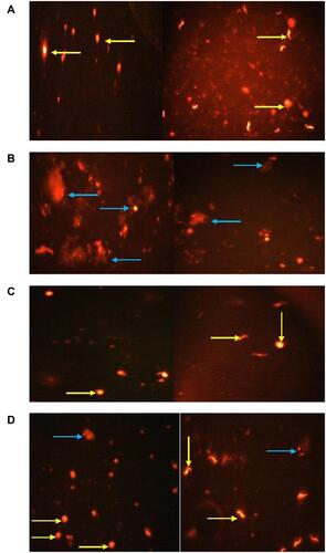 Figure 7 Comet assay in testicular tissue of rats showing the effects of exposure to Ag-NPs and/or Zn-NPs on DNA damage: (A) control group; (B) Ag-NPs group; (C) Zn-NPs group; (D) Ag-NPs + Zn-NPs group. Yellow arrow indicates a nucleus without tail (intact DNA). Blue arrow indicates a nucleus with tail (DNA break).