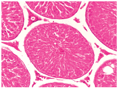 Figure 3.  Showing the section of Rat testis treated with Myristica fragrans Oil at the dose level of 0.2 ml/kg b. wt. for 60 days.