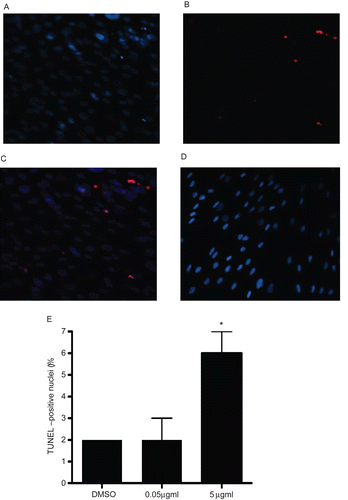 Figure 7.  TUNEL analysis of A549 cells treated with rhIL-16 for 24 h. (A) DAPI staining in 5.0 µg rhIL-16/ml-treated cells. (B) TUNEL-positive nuclei in 5.0 µg rhIL-16/ml-treated cells. (C) Merged images; arrows (chevrons) indicate TUNEL+ nuclei. (D) Control samples stained with DAPI and TUNEL (showing DAPI+ nuclei only; no signals were captured in case of TUNEL staining in control samples - thus, image not shown). (E) Percentages (%) of TUNEL+ cells among all control or rhIL-16-treated (0.5 or 5.0 µg/ml) A549 cells. The bars represent the mean TUNEL-positive cell percentage (± SD) from two samples per treatment regimen. Value significantly different at *P < 0.05 when compared to untreated cells’ value.