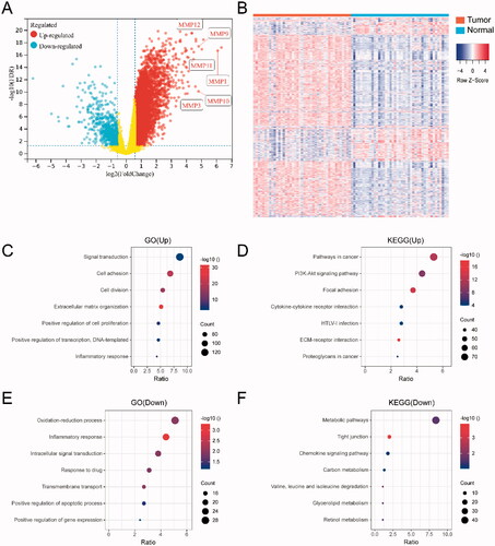 Figure 1. Differentially expressed gene (DEG) analysis between HNSCC tumor and adjacent normal tissues. (A) Volcano plot for the differential expressed genes; (B) the heatmap represents the mRNA expression levels of 2101 DEGs in 43 of HNSCC tumor tissue and 43 of adjacent normal tissues; (C) GO and (D) KEGG enrichment analysis results of 1535 up-regulated genes; (E) GO and (F) KEGG enrichment analysis results of 566 down-regulated genes.