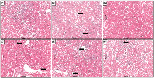 Figure 4. Effect of LG on STZ-induced alterations in kidney histology. Photomicrograph of sections of kidney of (A) normal, (B) diabetic control rats, (C) Sitagliptin (5 mg/kg, p.o.) treated rats (C), LG (250 mg/kg, p.o.)-treated rats (D), LG (500 mg/kg, p.o.)-treated rats (E) and LG (1000 mg/kg, p.o.)-treated rats. MT staining at 40×. Fibrosis (Black arrow).