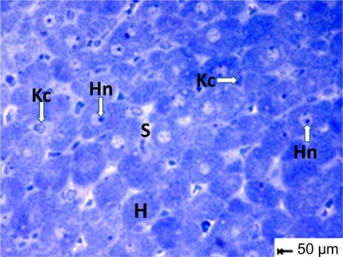 Figure 11 Semithin section of liver tissue from the treated group showing narrowing of the sinusoidal lumen. Scale bar 50 μm.Abbreviations: H, hepatocytes; Hn, hypertrophied nuclei; Kc, Kupffer cells; s,sinusoidal lumen.