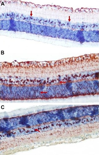 Figure 4 Micrographs of retinal S-100 staining for one rat in each treatment group.