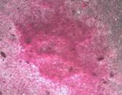 Figure 4. Osteogenic induction for 21 d, alizarin red staining of calcium nodules were red.