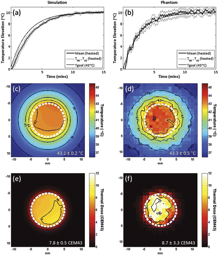 Figure 2. Simulations (a,c,e) and in vitro (b,d,f) testing of proportional-integral MRI temperature control for mechanically-scanned focused ultrasound hyperthermia. Mean, T90 and T10 temperatures in the 10 mm diameter circular region of interest for a target temperature elevation (Tgoal) of 10°C using controller gains KP = 4.5, KI = 0.03 and an exponential input function with time constant tau = 160 seconds, in simulation (a) and in vitro, heating a tissue-mimicking gel phantom (b). Temperature maps at 10 minutes after the start of heating, and thermal dose maps calculated from the same simulation (c,e) and in vitro (d,f) controlled heating data, assuming a target temperature of 43°C. 10 mm diameter circular scan trajectory outline in white.