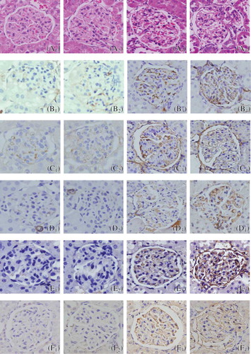 Figure 1. Glomerular morphology was normal in sham group (A1: 9 weeks; A2: 13 weeks; HE). Proliferation occurring in the majority of glomerular mesangial cells and extracellular matrix in GS group, and degeneration of glomerular epithelial cells and infiltration of widespread mononuclear cells were shown (A3: 9 weeks; A4: 13 weeks; HE), especially in 13 weeks of GS group (A4). Representative samples of immunohistochemical staining for glomerular Col-IV (SHO: B1: 9 weeks, B2: 13 weeks; GS: B3: 9 weeks and B4: 13 weeks), FN (SHO: C1: 9 weeks, C2: 13 weeks; GS: C3: 9 weeks and C4: 13 weeks), α-SMA (SHO: D1: 9 weeks, D2: 13 weeks; GS: D3: 9 weeks and D4: 13 weeks), TGF-β1 (SHO: E1: 9 weeks, E2: 13 weeks; GS: E3: 9 weeks and E4: 13 weeks), and apoE (SHO: F1: 9 weeks, F2: 13 weeks; GS: F3: 9 weeks and F4: 13 weeks) were observed in all groups. Sham group (B1, B2, C1, C2, D1, D2, E1, E2, F1, and F2): positive staining (in brown) was faint in glomerulus, glomerular endothelial cells, glomerular basement membrane, mesangial cells, and visceral epithelial cells. GS group (B3, B4, C3, C4, D3, D4, E3, E4, F3, and F4): positive staining was strong in most glomerulus, glomerular endothelial cells, glomerular basement membrane, mesangial cells, and visceral epithelial cells, especially in those of 13 weeks (B4, C4, D4, E4, and F4). Magnification 400×.Notes: SHO, sham operation group; GS, glomerulosclerosis model group; HE, hematoxylin and eosin; FN, fibronectin; α-SMA, α-smooth muscle actin; TGF-β1, transforming growth factor-β1; apoE, apolipoprotein E.