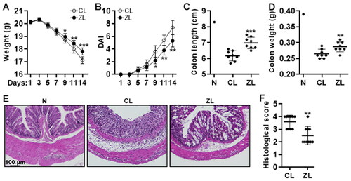 Figure 6. The effect of ZFP189 knockdown on colitis severity. (A) Mouse body weight. (B) Disease activity index. (C & D) Colon length (C) and weight (D) on day 14. (E) H&E staining of colons on day 14. (F) Colon histological scores on day 7. CL: transfer of control Th17.1 cells. ZL: transfer of ZFP189-deficient Th17.1 cells. N: normal recipient without any treatment. N = 8 to 10 mice per group. *: p < 0.05; **: p < 0.01; ***: p < 0.001.