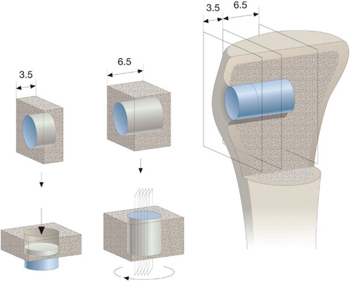 Figure 1. Sectioning technique. Implant in situ in the tibia metaphyseal bone is illustrated to the right. Inner part of 6.5 mm was used for histomorphometry using the vertical-section method applying 4 sections around implant center after random rotation around implant axis (center panel). Outer part of 3.5 mm was used for mechanical testing (left panel).