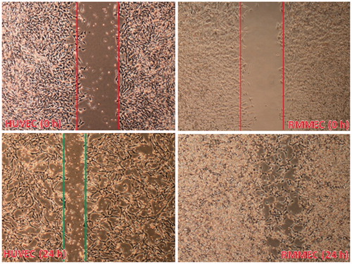 Figure 3. Migration of RMMECs and HUVECs. The representative images of cell migration in the scratch wound-healing model were evaluated under a light microscope at 900× magnification after 24 h of incubation. Red (top) and green (bottom) vertical lines depicted the initially wounded and remained unoccupied regions, respectively. Data shown are representative of the results of three independent experiments. For interpretation of the references to color in this figure legend, the reader is referred to the web version of this article.