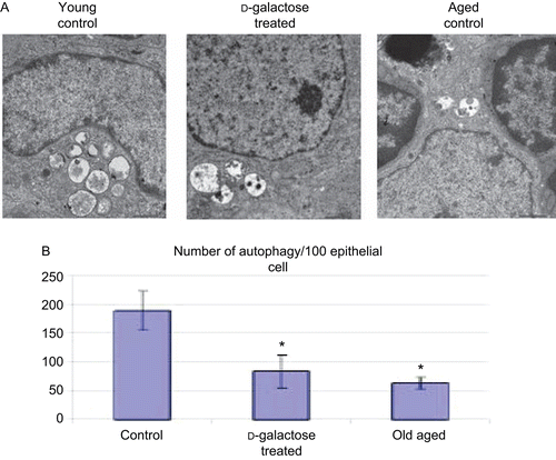 Figure 4.  Distribution of autophagic vacuoles in TEC. (A) Electron micrograph (4000×) of thymus from C57BL/6J mice injected SC (daily, for 60 days) with PBS (control; n = 4) or d-galactose (50 mg/kg BW, n = 4; see Figure 1 legend for details), and from aged (24-month-old, n = 3) control mice. 70-nm ultrathin sections were stained with uranyl acetate and lead stain solution and examined using a TEM. An autophagic vacuole (arrow) in thymic epithelial cell is shown (at 4000×). The images here are from a representative mouse from each of the indicated regimens. (B) Total number of TEC in the thymic ultrastructure and autophagic vacuoles in TEC were counted; values shown are mean (± SD) number of autophagic vacuoles/100 TEC counted in samples from each indicated group of mice. *Value significantly different from that seen with the control young mice.