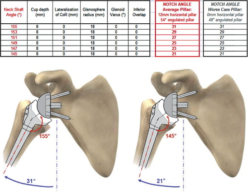 Figure 3. Influence of neck-shaft inclination on the notch angle. (Simulation of maximal adduction in average scapular morphology and in worse-case scapular anatomy: no horizontal pillar. Images of average scapular morphology).